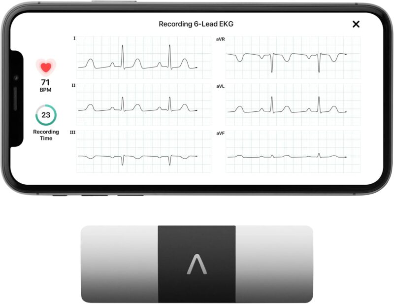 Instant Heart Health: KardiaMobile 6-Lead EKG Monitor Review