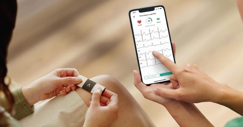 Instant Heart Health: KardiaMobile 6-Lead EKG Monitor Review