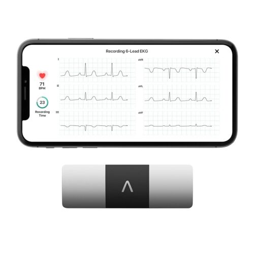 Instant Heart Health: KardiaMobile 6-Lead EKG Monitor Review