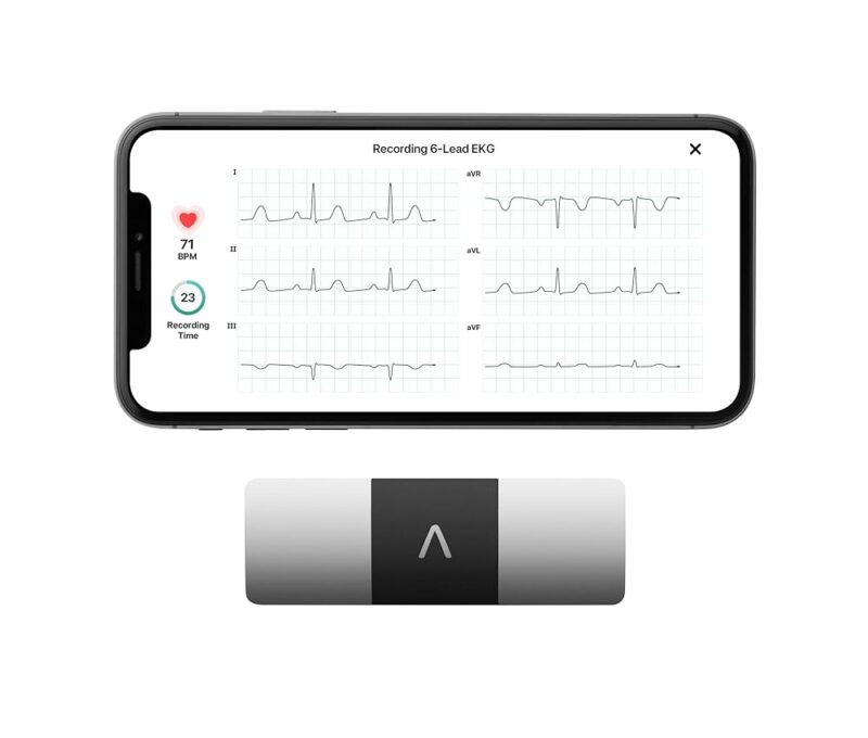 Instant Heart Health: KardiaMobile 6-Lead EKG Monitor Review