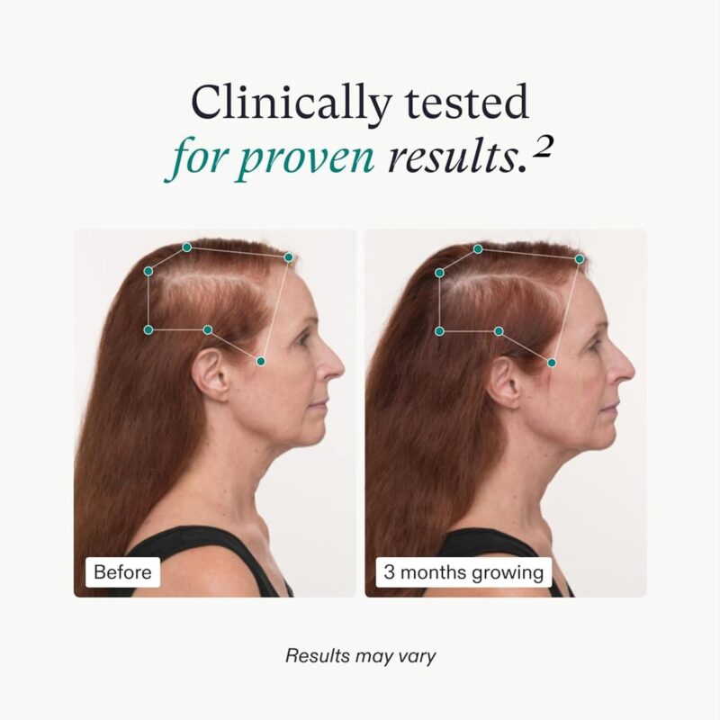 Nutrafol Women's Balance: Clinically Proven Hair Growth for Ages 45+