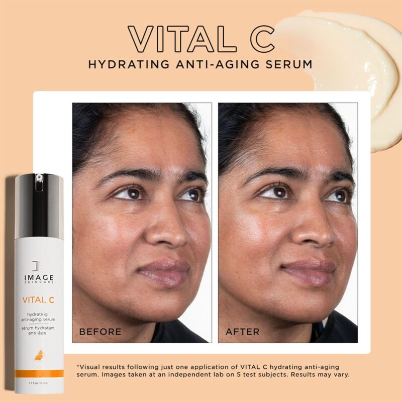 Revitalize Your Skin: A Review of IMAGE Skincare VITAL C Serum